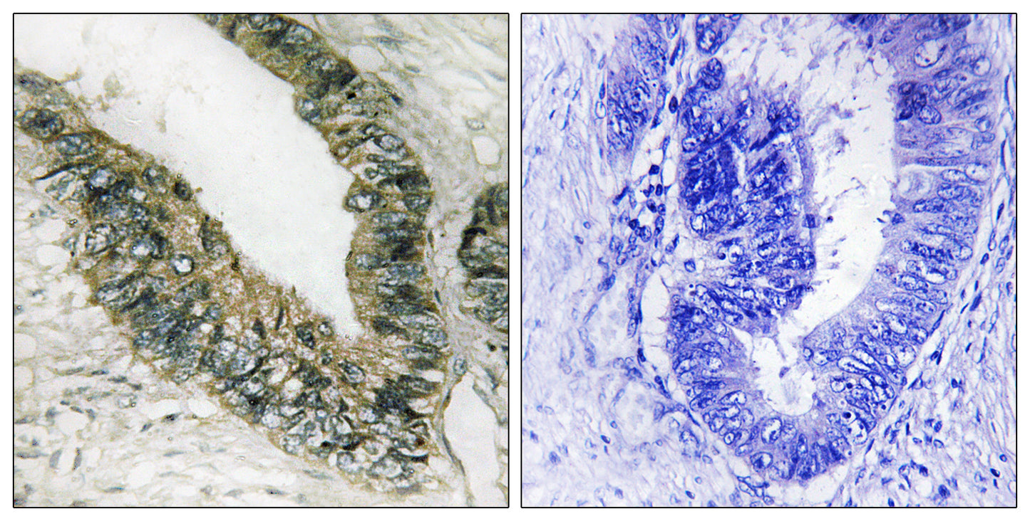 PERK Rabbit Polyclonal Antibody