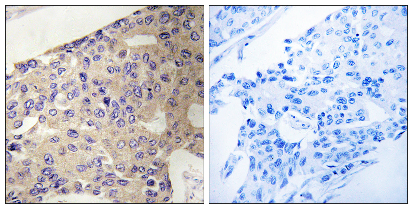 Peroxin 10 Rabbit Polyclonal Antibody