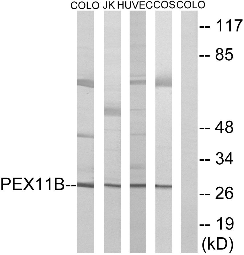 Peroxin 11β Rabbit Polyclonal Antibody