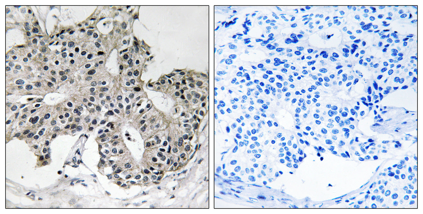 Peroxin 2 Rabbit Polyclonal Antibody