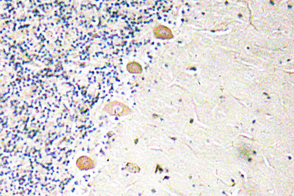 PFKM Rabbit Polyclonal Antibody