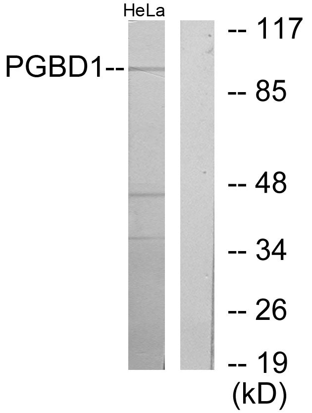 PGBD1 Rabbit Polyclonal Antibody