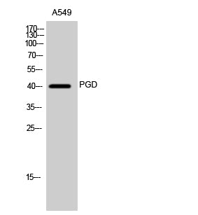 PGD Rabbit Polyclonal Antibody