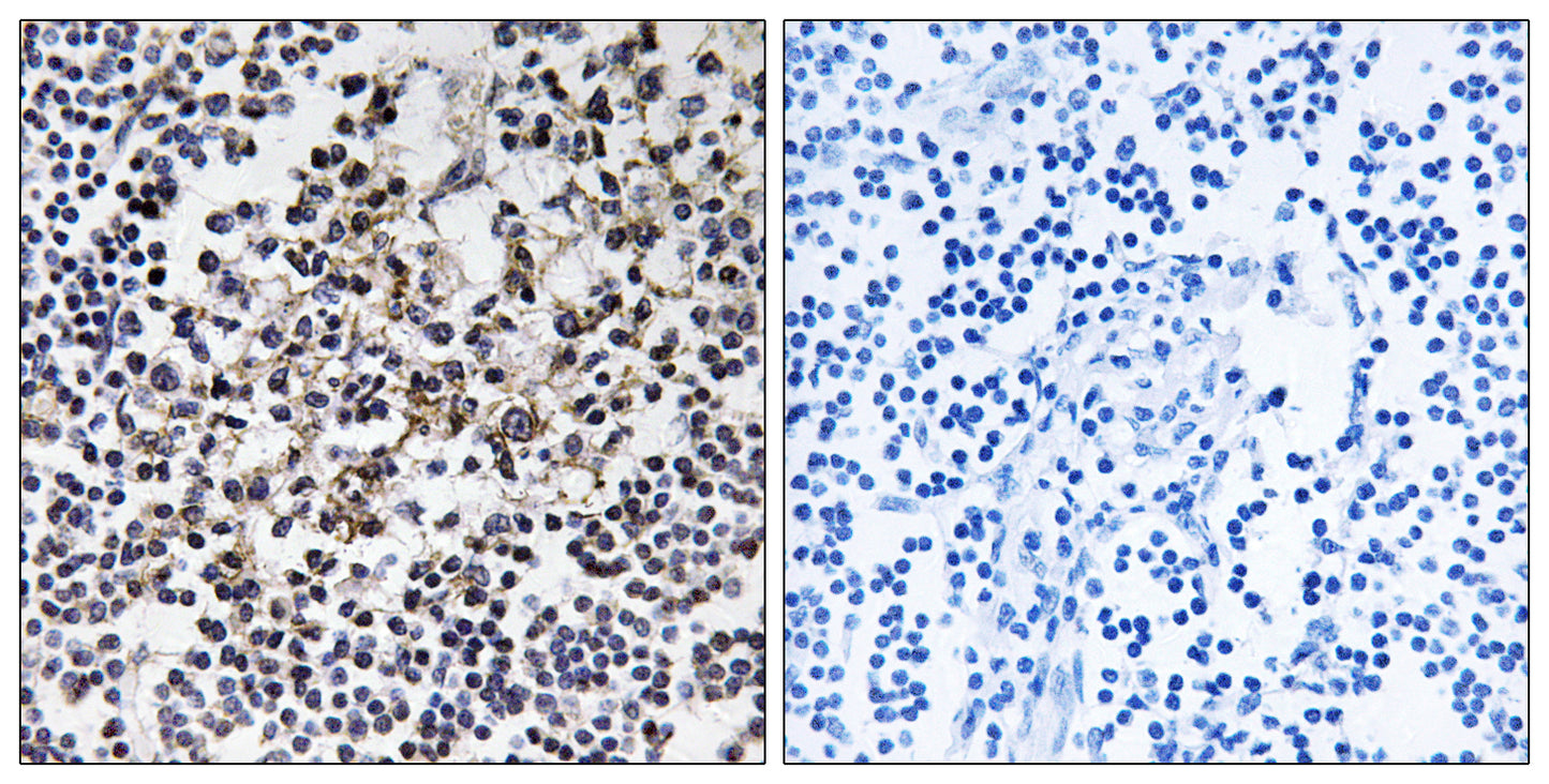 PGLS Rabbit Polyclonal Antibody
