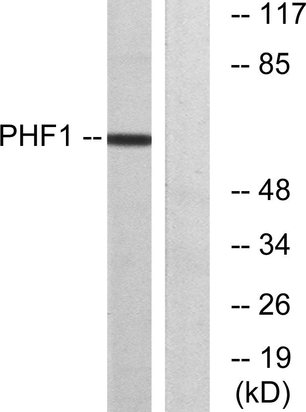 PHF1 Rabbit Polyclonal Antibody