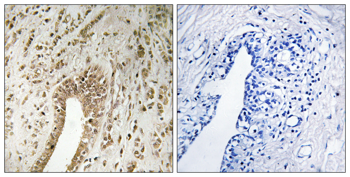 PHF3 Rabbit Polyclonal Antibody