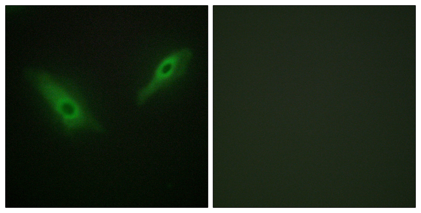 PHKA1/2 Rabbit Polyclonal Antibody