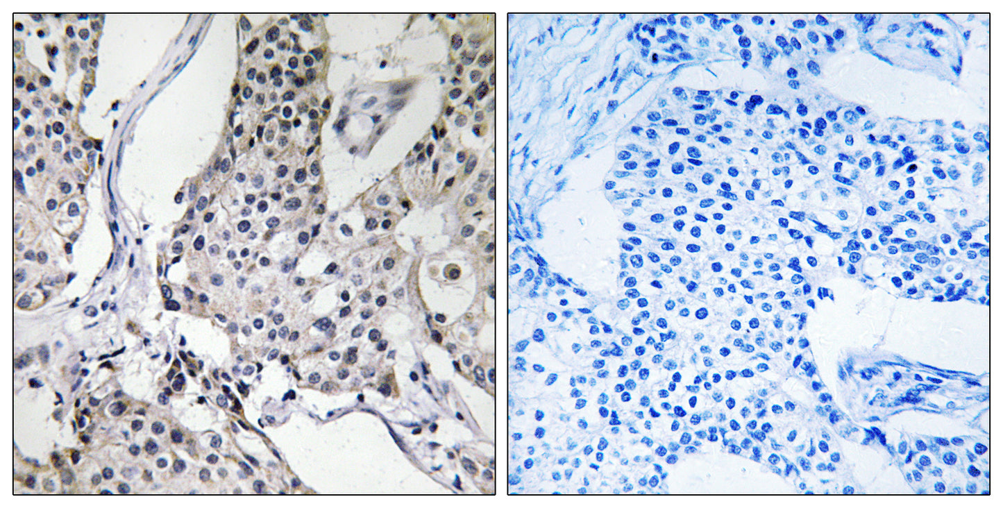 PHLDA3 Rabbit Polyclonal Antibody