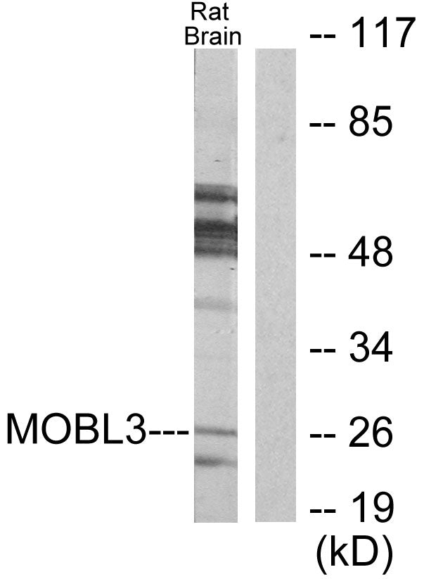 Phocein Rabbit Polyclonal Antibody