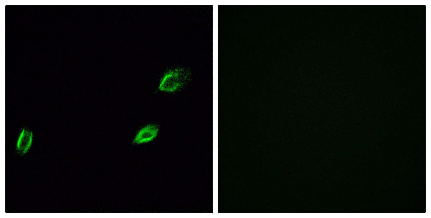 Photomedin-1 Rabbit Polyclonal Antibody