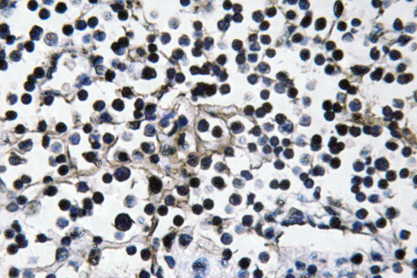 PI 3-kinase p110α Rabbit Polyclonal Antibody