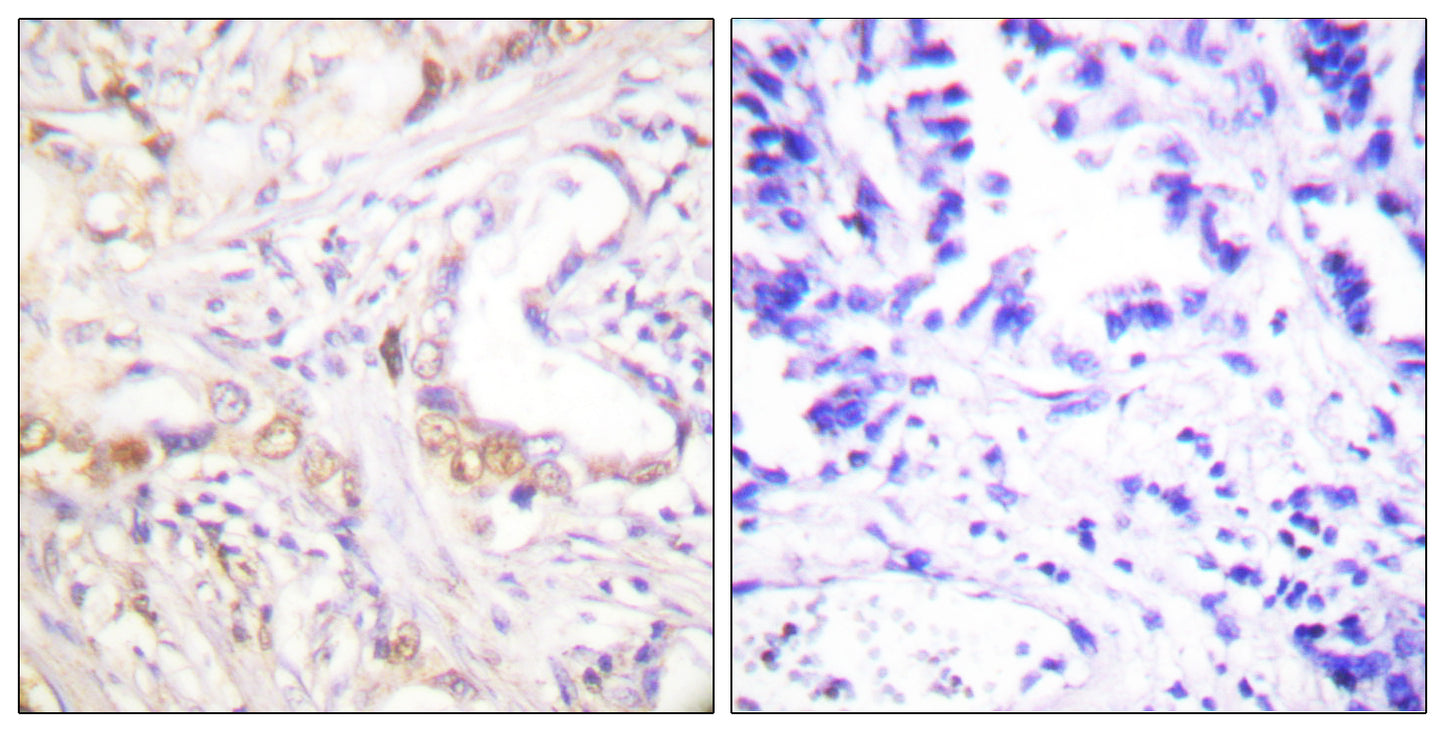 PIAS 3 Rabbit Polyclonal Antibody