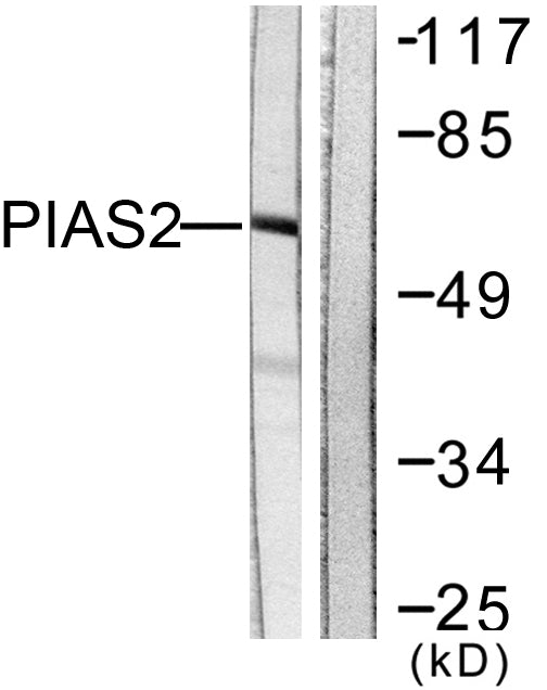 PIASx Rabbit Polyclonal Antibody