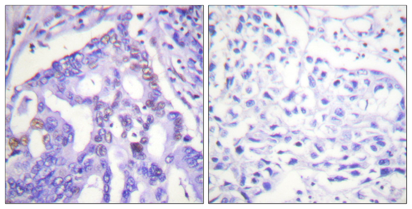 PIASy Rabbit Polyclonal Antibody