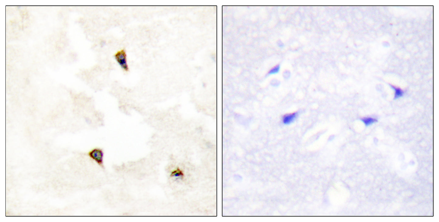 PIG11 Rabbit Polyclonal Antibody