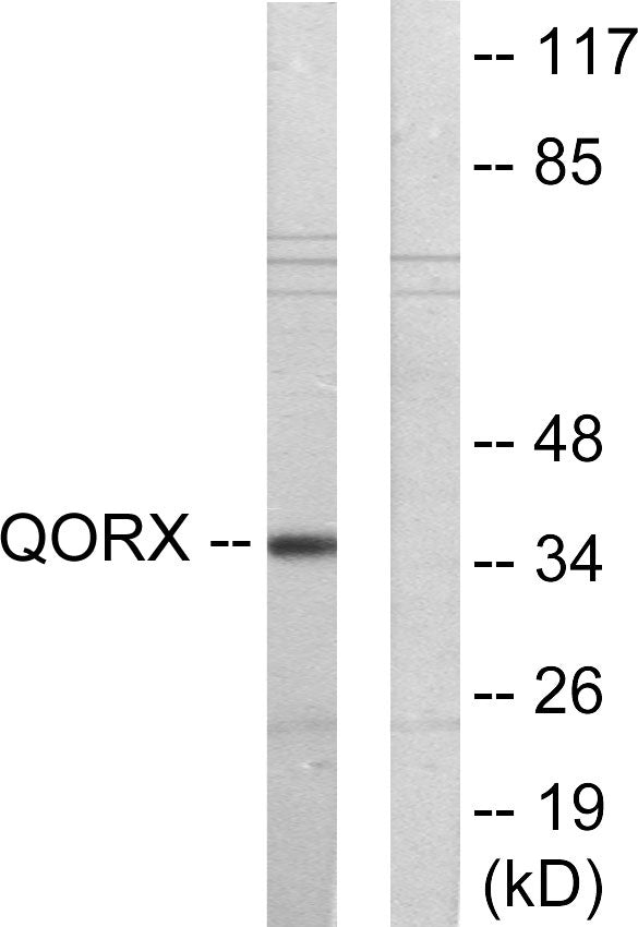 PIG3 Rabbit Polyclonal Antibody