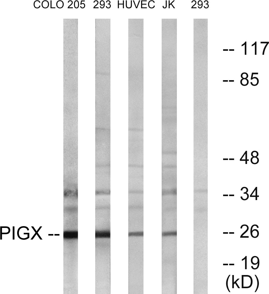 PIG-X Rabbit Polyclonal Antibody