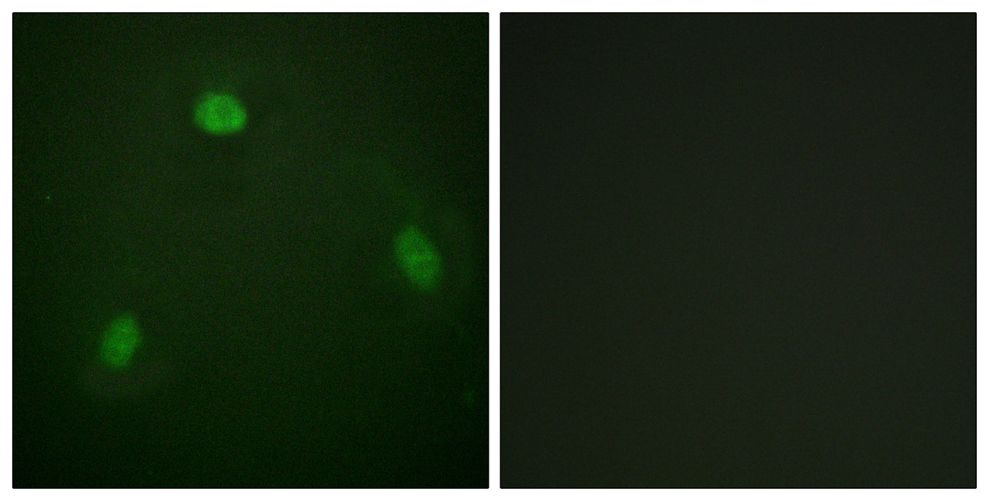 Pin1 Rabbit Polyclonal Antibody