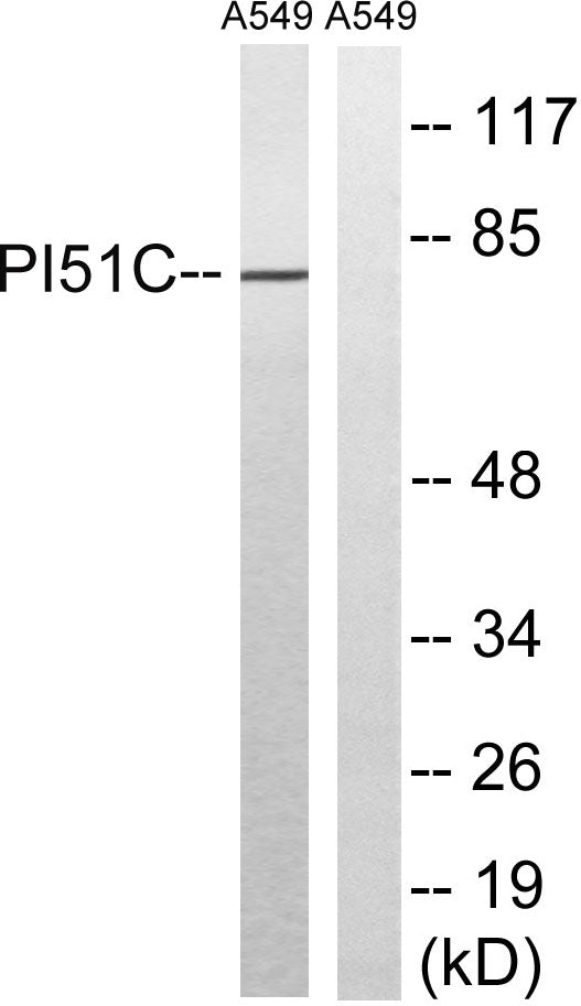 PIPK I γ Rabbit Polyclonal Antibody