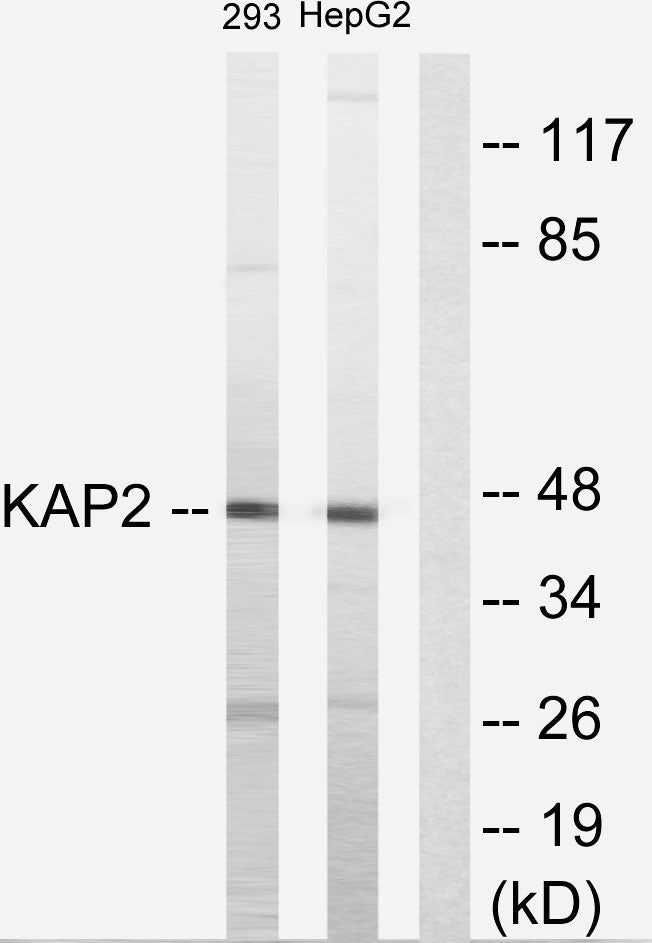 PKA IIα reg Rabbit Polyclonal Antibody