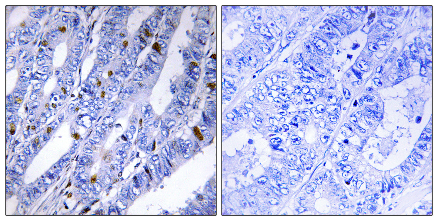 PKA IIβ reg Rabbit Polyclonal Antibody