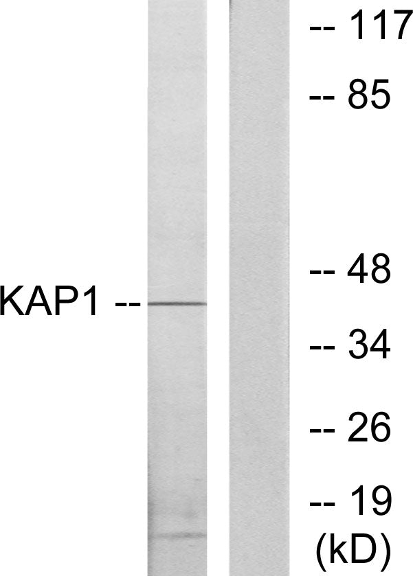 PKA Iβ reg Rabbit Polyclonal Antibody