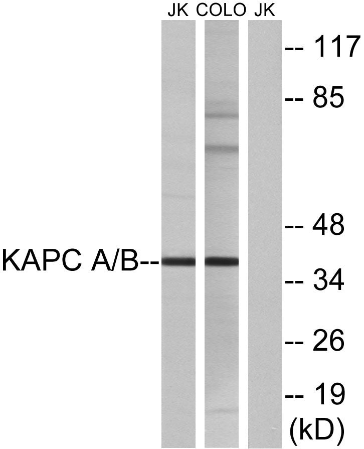PKAα/β cat Rabbit Polyclonal Antibody