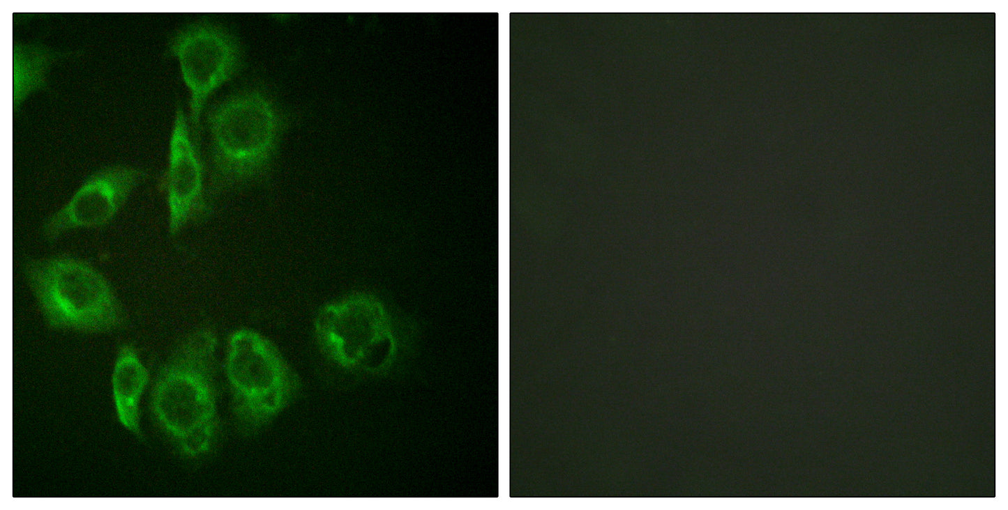 PKC Rabbit Polyclonal Antibody