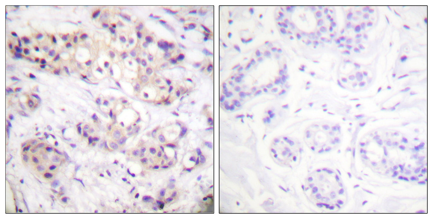 PKC α Rabbit Polyclonal Antibody