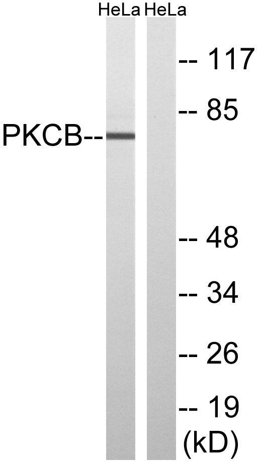 PKC β Rabbit Polyclonal Antibody