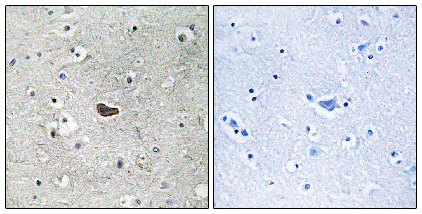 PKC δ Rabbit Polyclonal Antibody