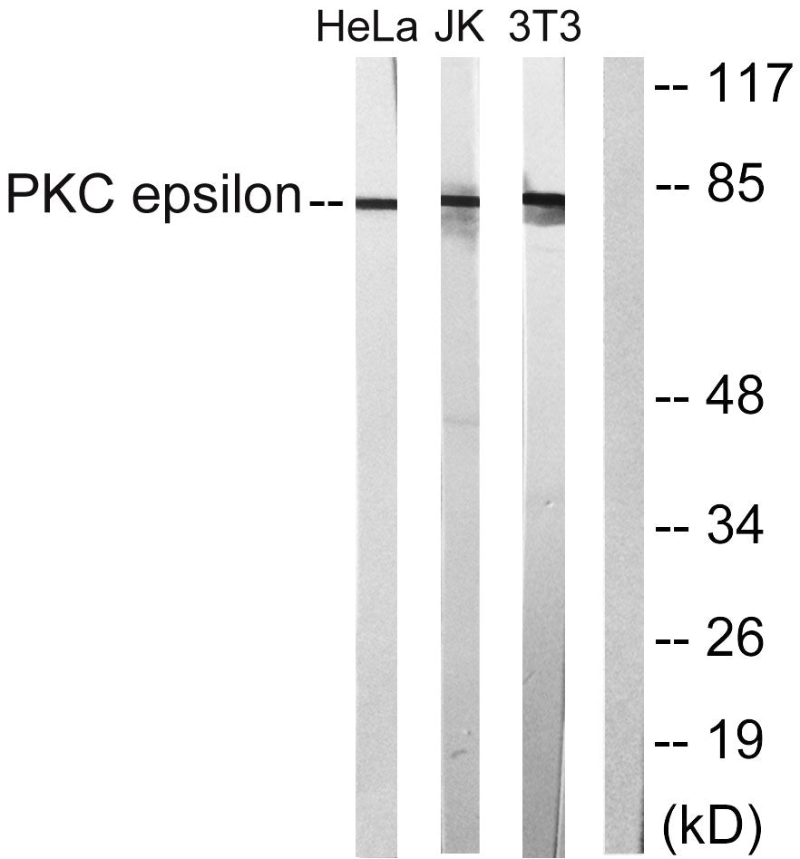 PKC ε Rabbit Polyclonal Antibody