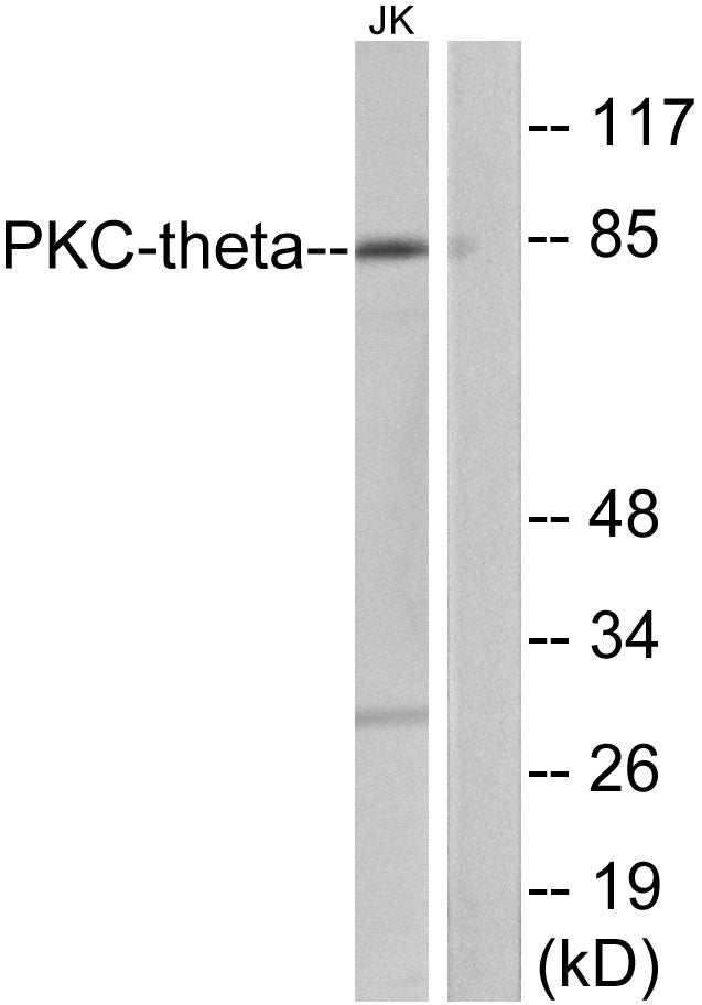 PKC θ Rabbit Polyclonal Antibody