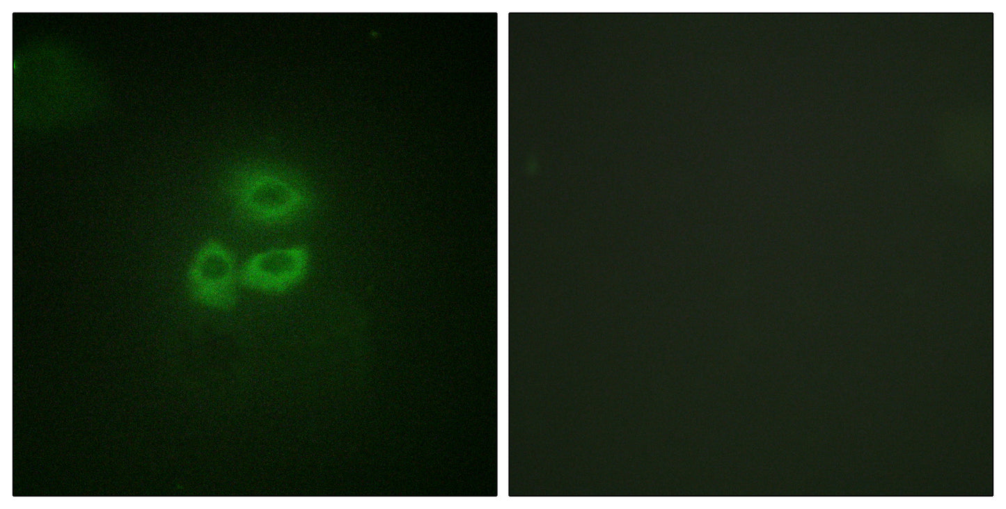 PKD1 Rabbit Polyclonal Antibody