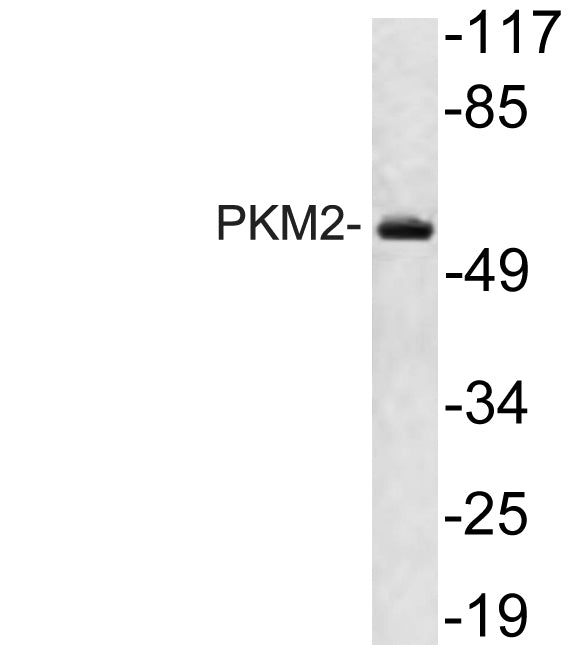 PKM2 Rabbit Polyclonal Antibody