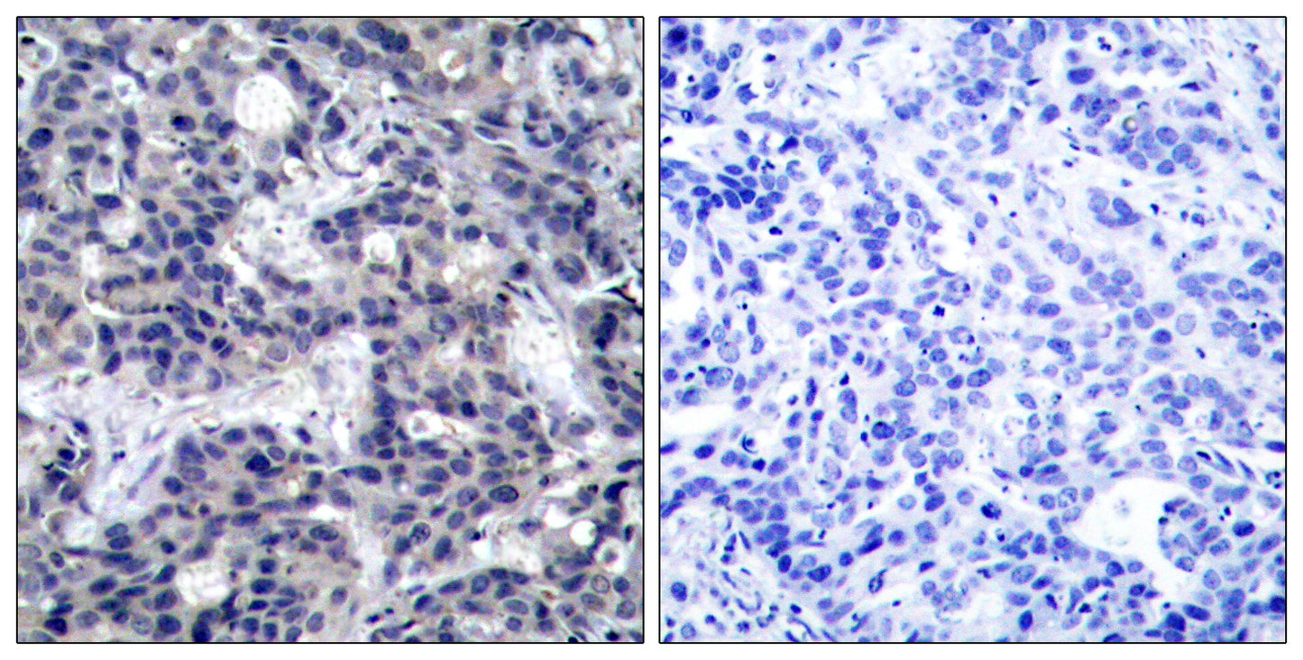 PKR Rabbit Polyclonal Antibody