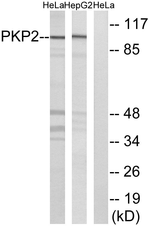 Plakophilin 2 Rabbit Polyclonal Antibody