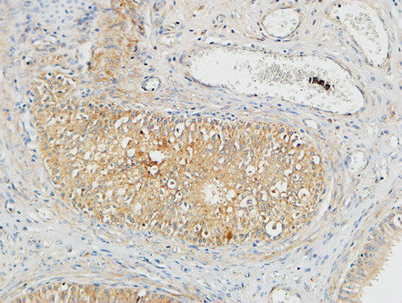 Plasminogen Rabbit Polyclonal Antibody