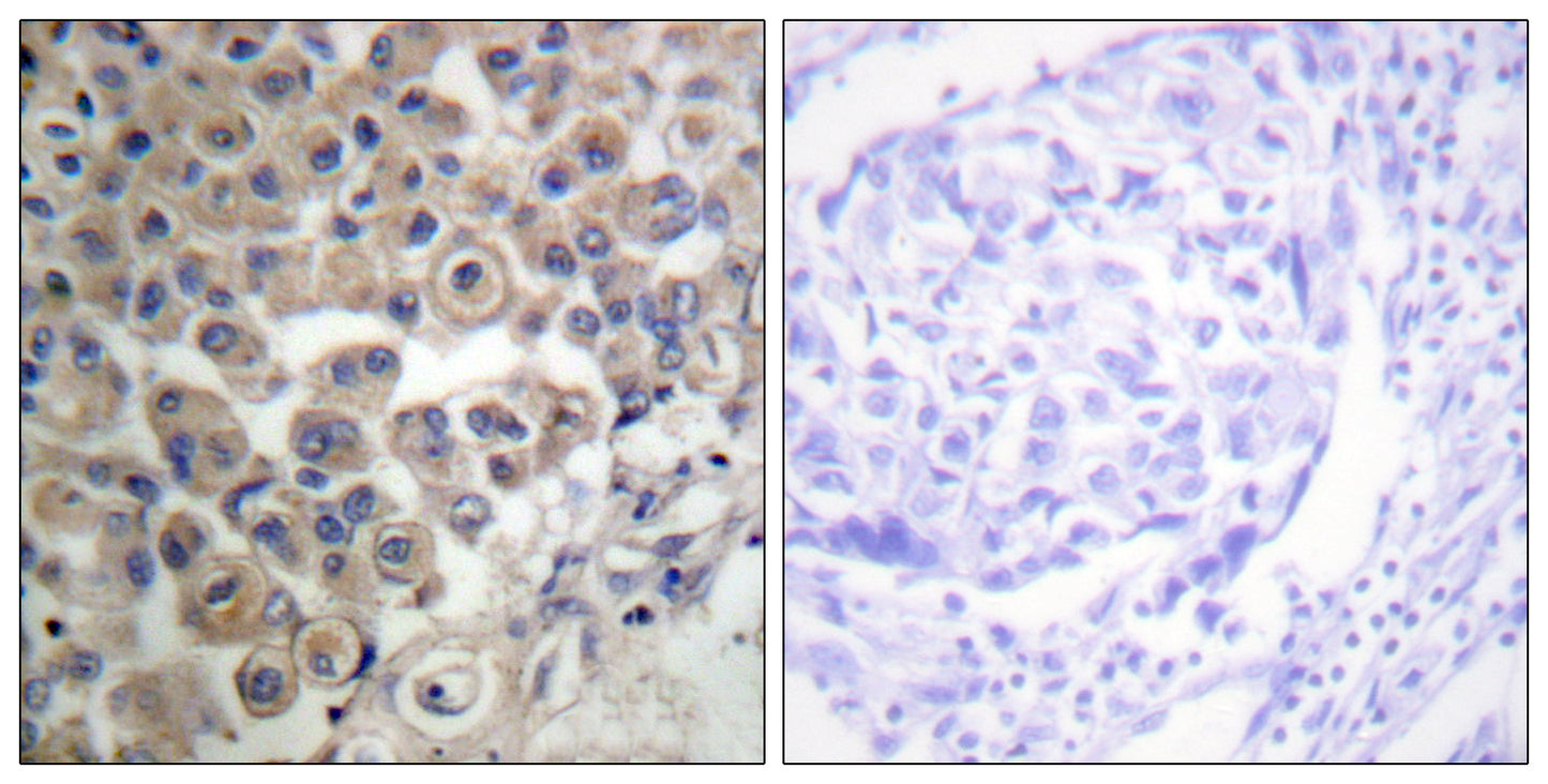 PLC β3 Rabbit Polyclonal Antibody