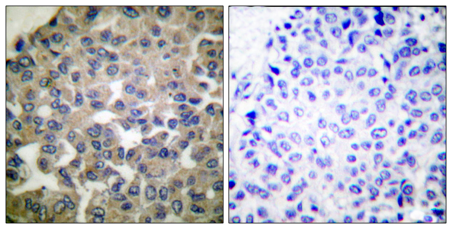 PLC γ1 Rabbit Polyclonal Antibody