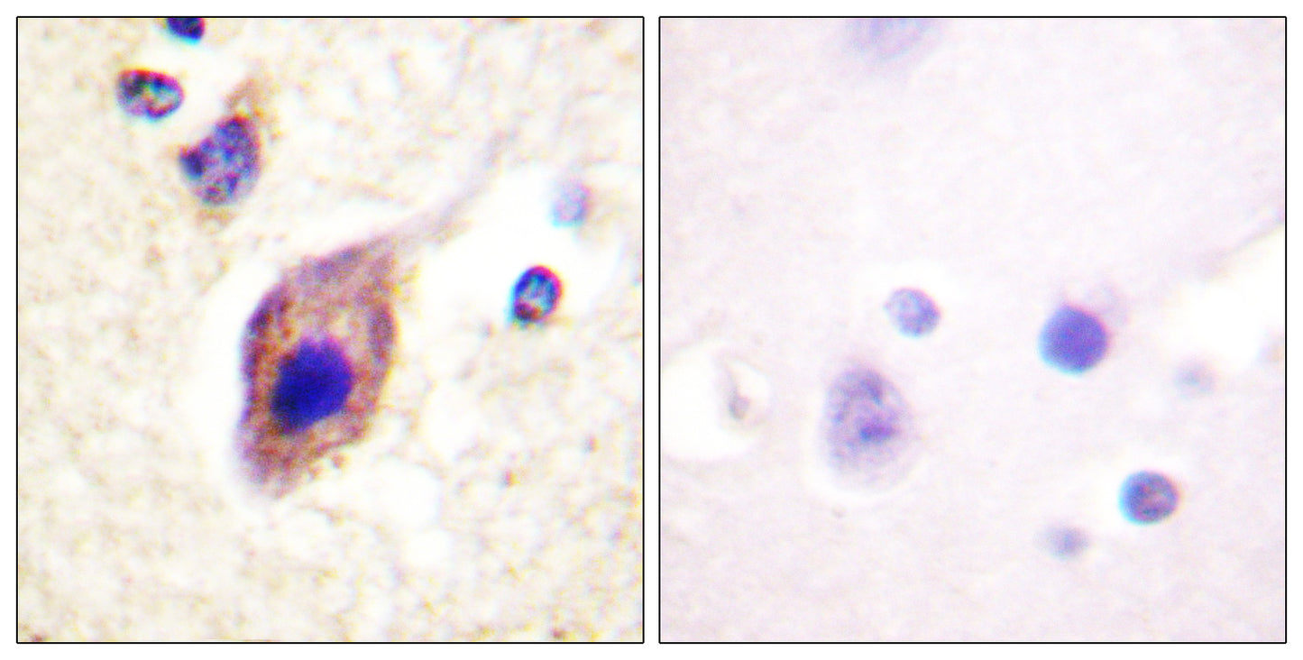 PLC γ2 Rabbit Polyclonal Antibody
