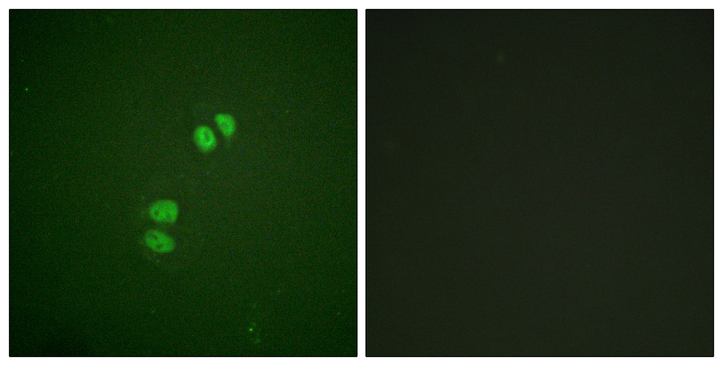 Plk Rabbit Polyclonal Antibody