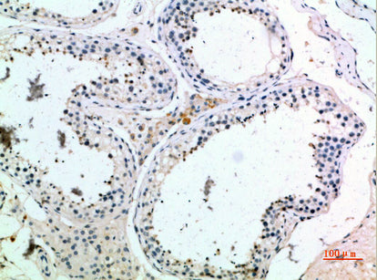 PMCH Rabbit Polyclonal Antibody