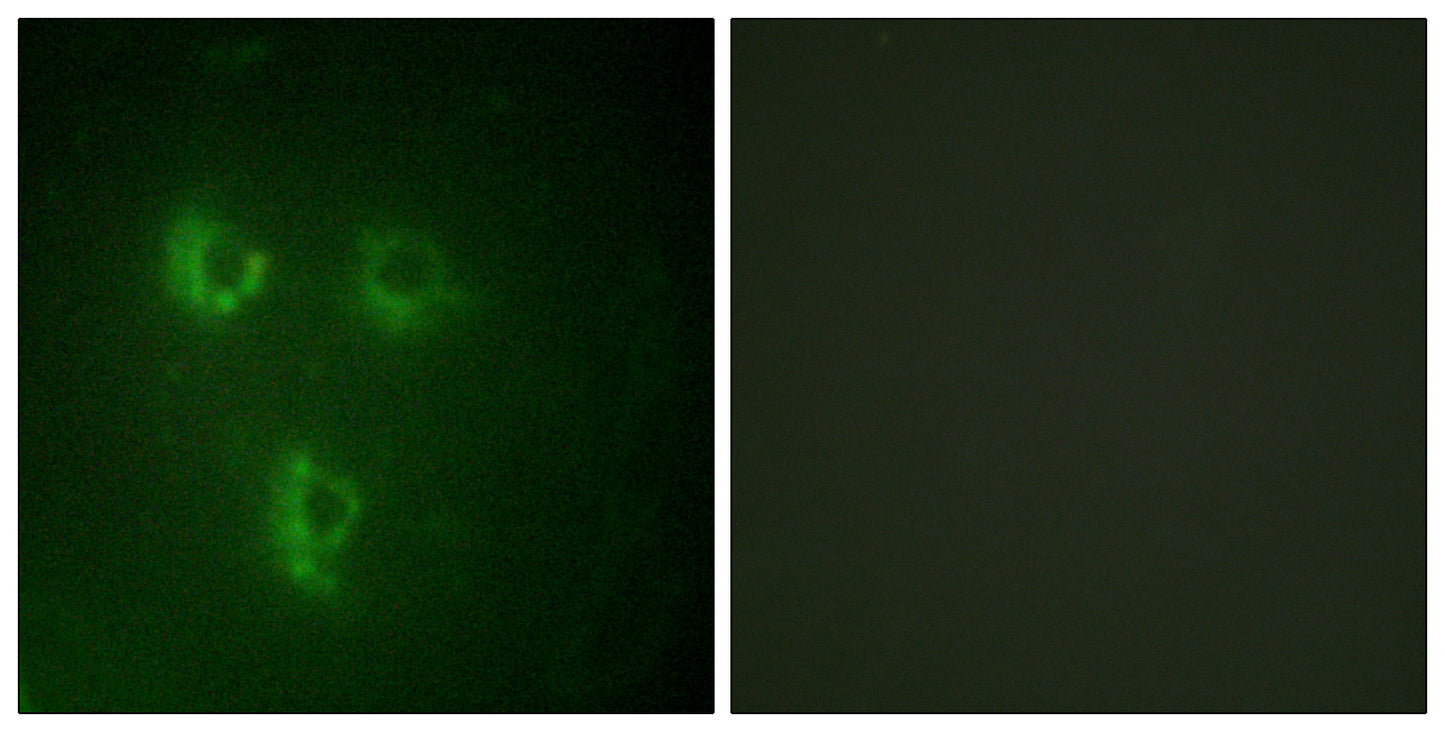 PMEPA1 Rabbit Polyclonal Antibody