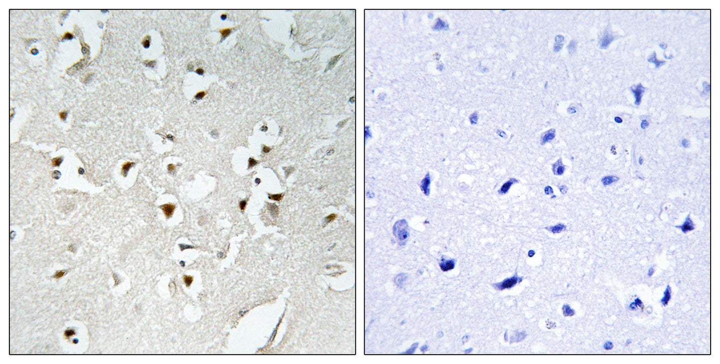 PMS1 Rabbit Polyclonal Antibody