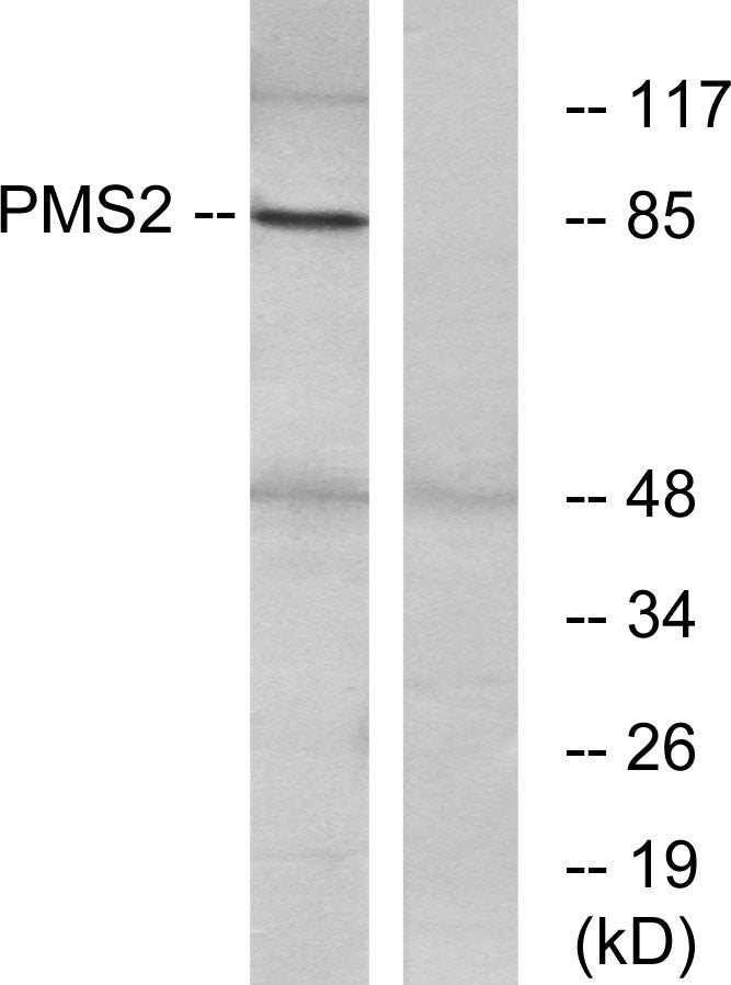 PMS2 Rabbit Polyclonal Antibody
