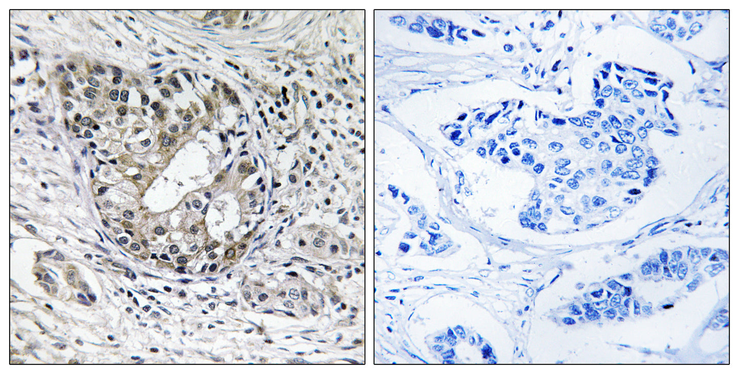 PNPase Rabbit Polyclonal Antibody