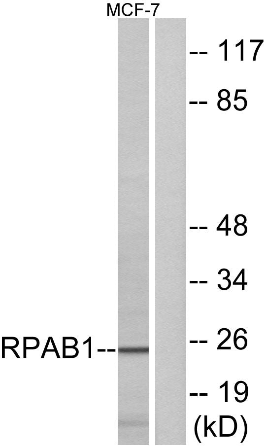 POLR2E Rabbit Polyclonal Antibody
