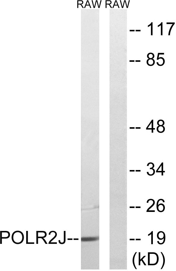 POLR2J1 Rabbit Polyclonal Antibody