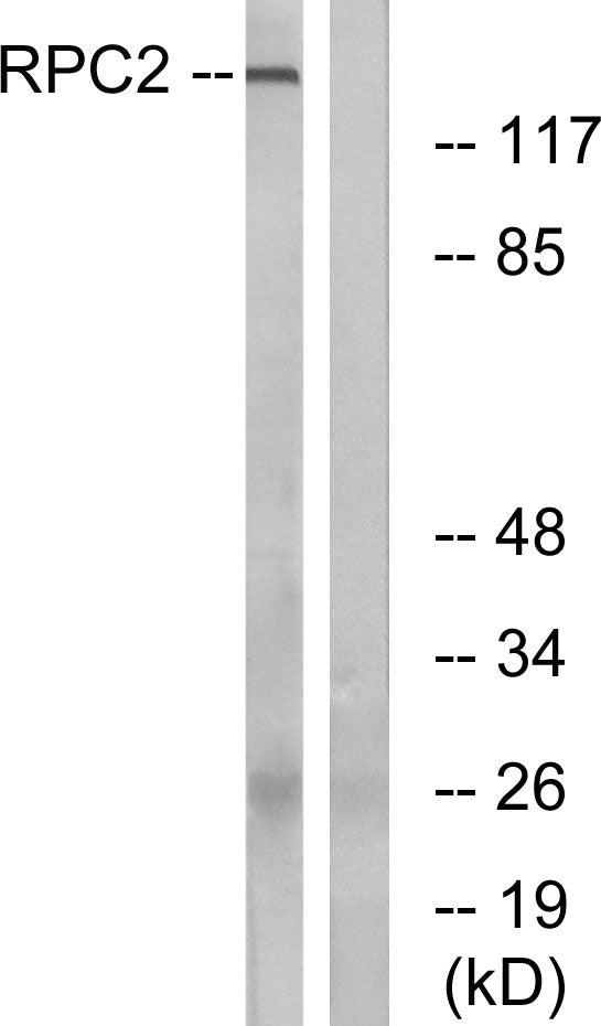 POLR3B Rabbit Polyclonal Antibody